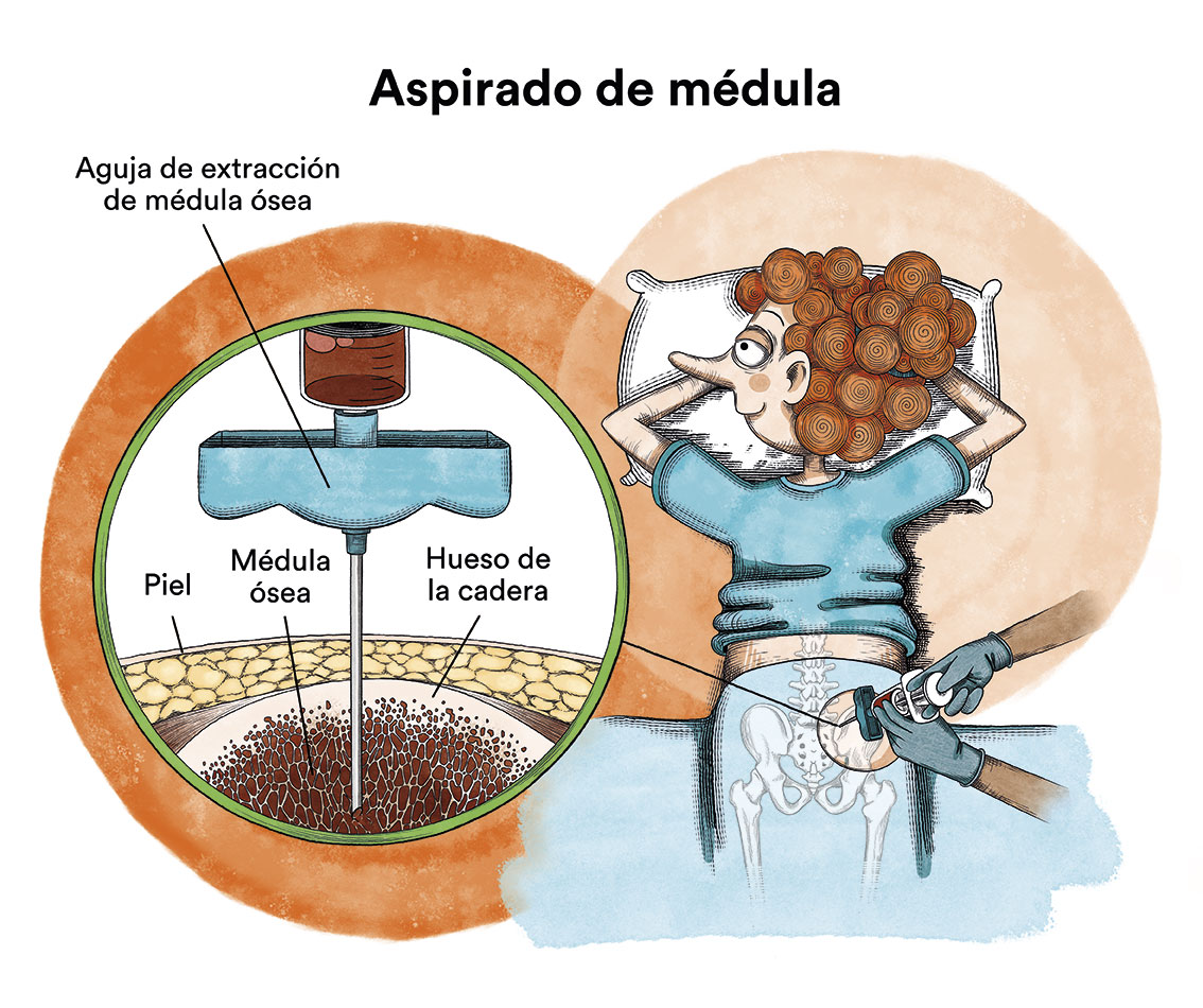 Aspirado de médula